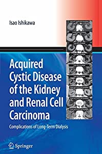 Acquired Cystic Disease of the Kidney and Renal Cell Carcinoma: Complication of Long-term Hemodialysis(中古品)