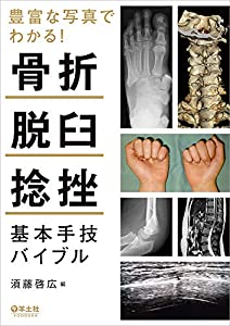 (中古品)豊富な写真でわかる! 骨折・脱臼・捻挫 基本手技バイブル/羊土社/?藤 啓広: Editor/全身の50種類以上の整形外傷について,初期診療の指針・要点を明確に解説!さらに多彩な画像やイラス